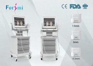 China high intensity focused ultrasound hifu radio frequency face lift machine factory