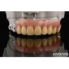 Buy cheap Elaborate Dental Stable Oral Structure Framework Set Up Teeth Finish For Optimal from wholesalers