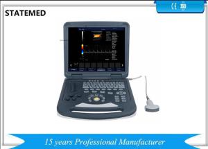 China Full Digital Portable Doppler Ultrasound Machine Diagnostic For Pregnancy factory