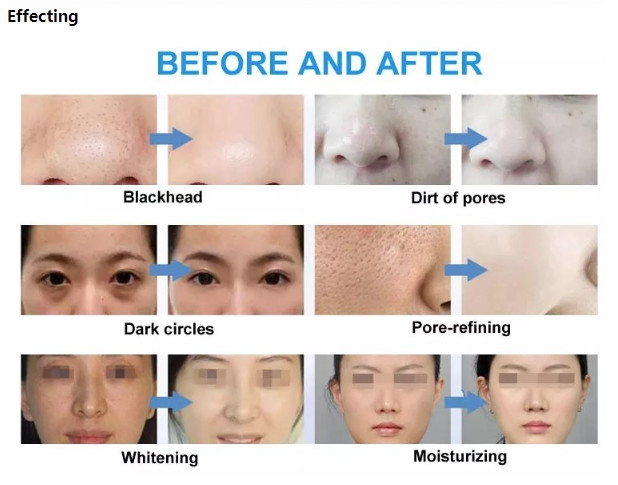 6 In 1 Photon Light Therapy Machine PDT Hydrafacial Care Beauty Device