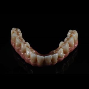 China Fixed Restorations Full Arch Zirconia Implant Bridge Denture Teeth factory