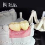 Smooth Surface Implant Cases Steam Sterilization Dental Implant Cases