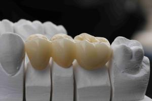 China Pre Colored 98*16mm 3D Multilayer Zirconia Block factory
