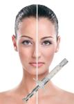 Face Lift PCL Dermal Filler Skin Care Lifting Tightening Stimulating Collagen