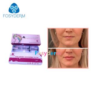 China Fosyderm 2ml Dermal Lip Fillers Hyaluronic Acid Lip Enhancement Injection Derm Line factory
