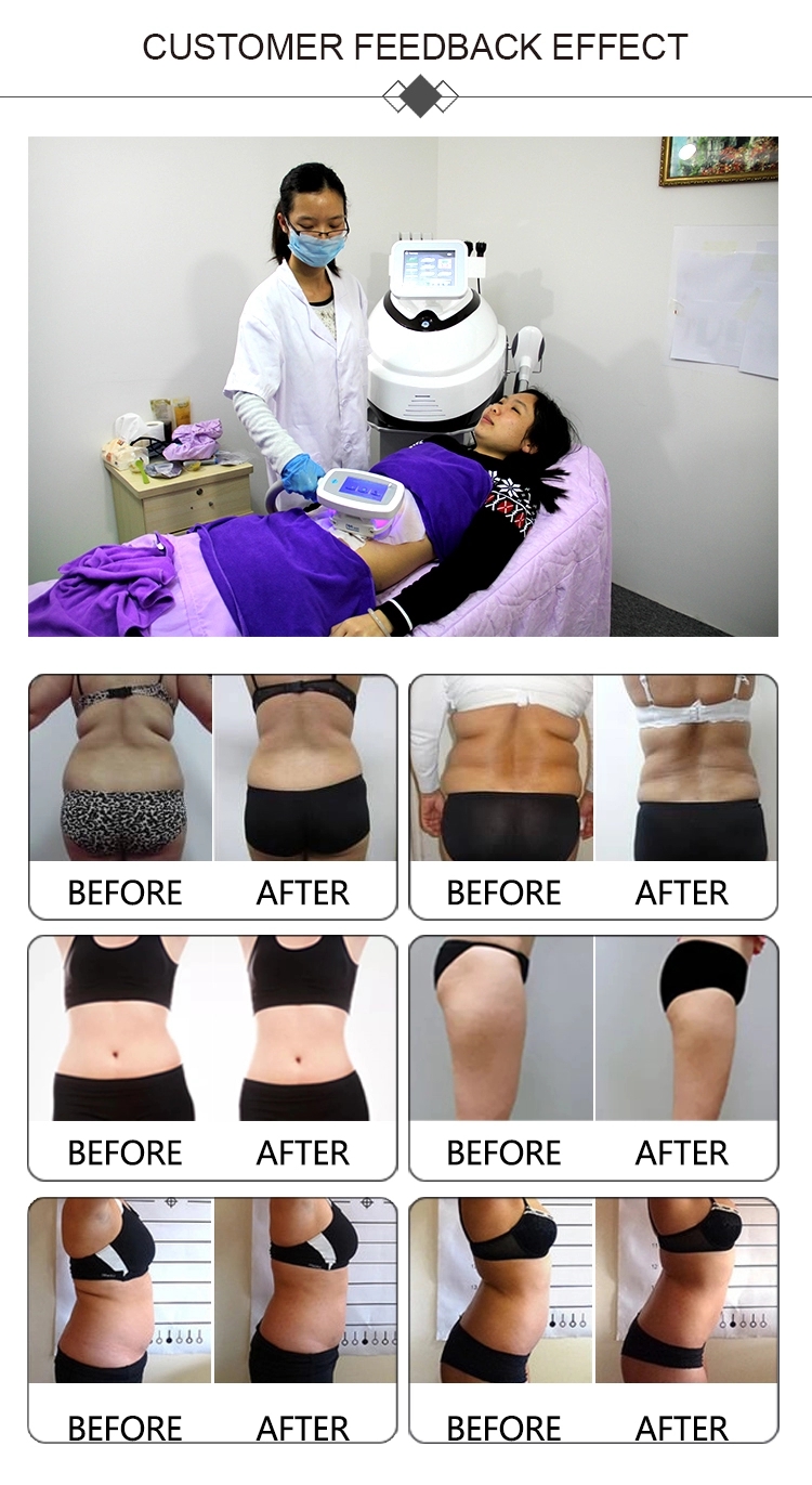 DM-55 Portable RF Cryolipolysis Slimming Machine 350mW pulse Fat Freezing