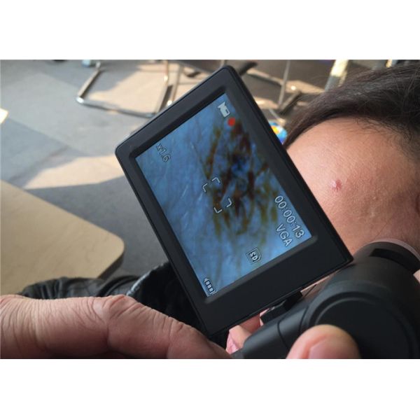 Small Video Dermatoscope Camera Skin And Hair Microscope High Image Resolution With 3 Inch LCD Rotable Screen