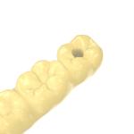 Non Toxic Light Curable Resin Temporary Crown Fabrication Dental Resin