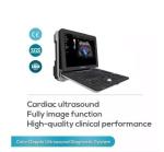 Cardiovascular Cardiology Portable Full Figital Color Doppler Ultrasound Scanner