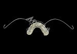 Aesthetic Orthodontic Appliance Modified Activator Durable Material for