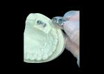 Long-lasting Full Cast Titanium Crown Dental Implant Molar For Missing Teeth