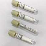 Sodium Flouride Glucose Blood Tube 1-8ml Draw Volume Accurate Ratio