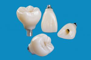 China Professional Zirconia Dental Implant Crown Titanium CAD CAM factory
