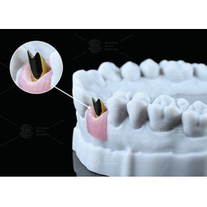 Internal Hex Custom Titanium Abutment Screw Cement Retained Varying Shape