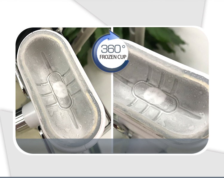 OEM Portable Cryolipolysis Machine , Cryo Weight Loss Machine 200W
