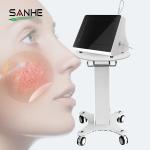 Portable 980nm diode laser vascular therapy machine / red blood vessels spider