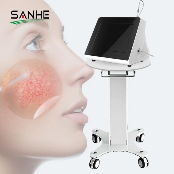 Portable 980nm diode laser vascular therapy machine / red blood vessels spider