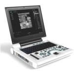 DICOM Portable 3D Ultrasound Machine Doppler Medical Instrument 64G