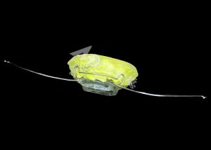 China Aesthetic Orthodontic Appliance Modified Activator Durable Material for Effective Jaw Alignment factory
