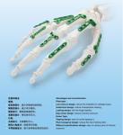 120 Degree Metacarpal Plate Titanium Bone Implants OEM ODM