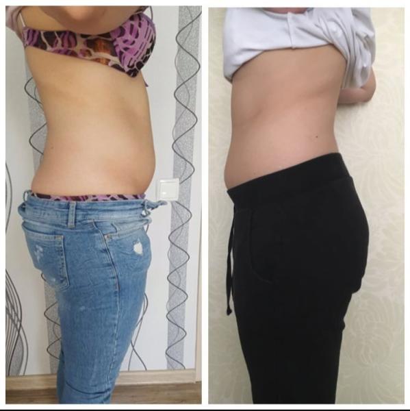 Fat Freeze slimm best seller 5 heads cryolipolysis slimming lipolaser fat
