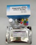 Medical Rapid Diagnostic 96pcs Elisa Test Kit Hbsag Hepatitis B Surface Antigen