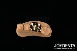 Metallic FMC Oral Clinical Repair Dental Implant Materials with Abrasive