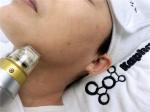 25 Pins 3.0mm Fractional Rf Microneedle Machine Scar Removal