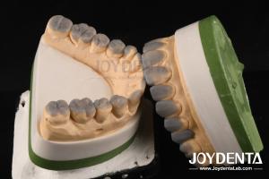 China Highly Accurate Temporary Dental Diagnostic Wax Up Customized 1-2mm Thickness factory
