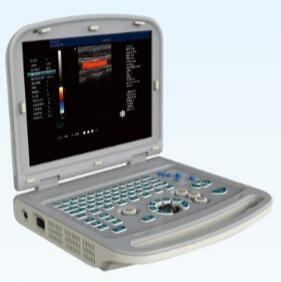 China New Arrival- 15 inch Laptop Color Doppler Ultrasound Diagnostic System EW-C15 with Vaginal on sale