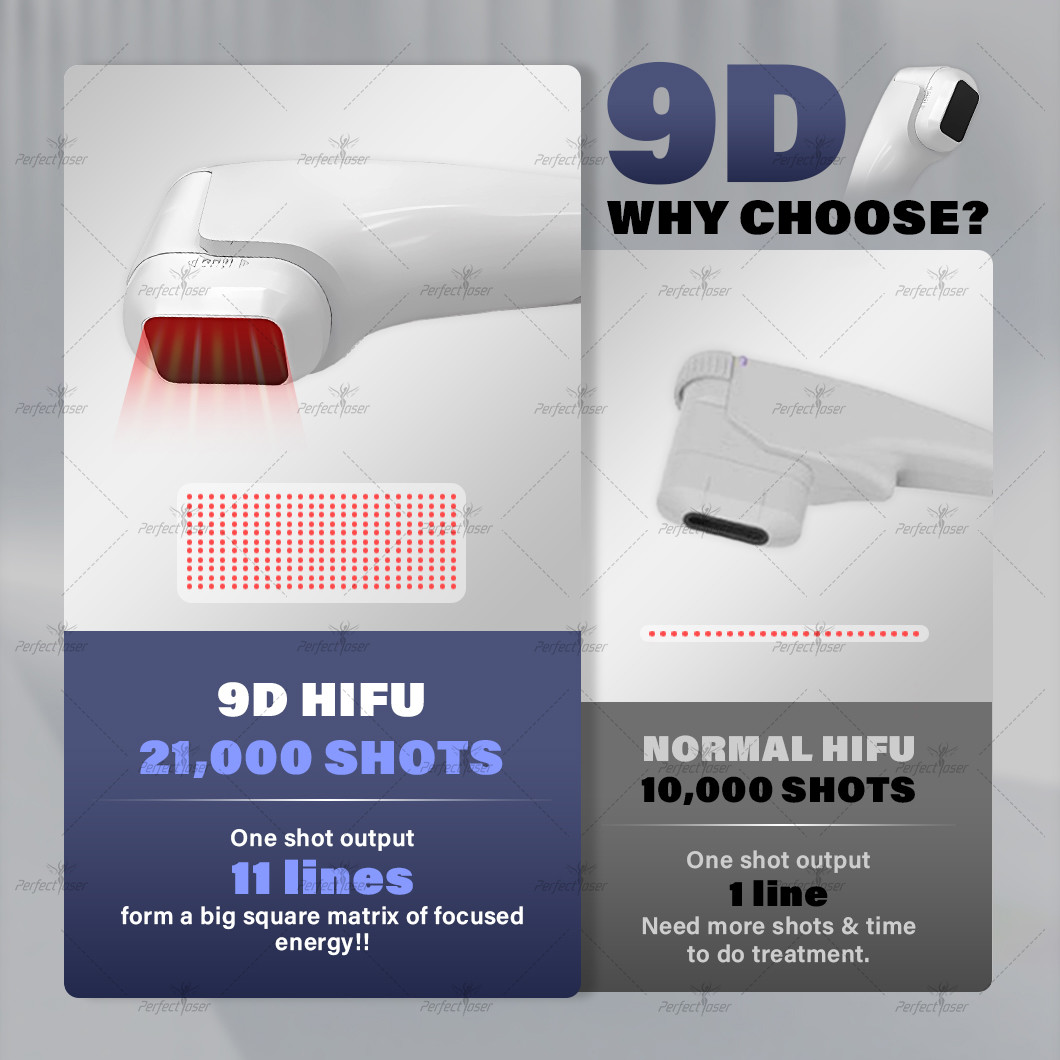 HIFU Machine Adjustable Lines 60 000 Shots Ultra large HD Screen for Body Contouring