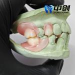 Flexibility Meets Invisibility Dental Flexible Resin for Full Dentures
