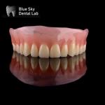 Restoration Full Upper Acrylic Denture Blue Sky Removable Acrylic Denture