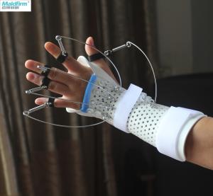 China Thermoplastic Dynamic Finger Extension Splint Occupational Therapy factory