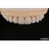 Buy cheap Smooth And Lightweight Dental Veneers Biocompatible And Comfortable For Oral from wholesalers