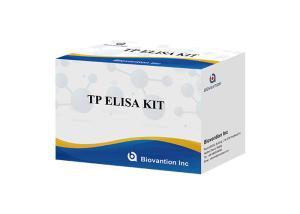 China Hospital, Medical Center,Self High AccuracyAnti-TP ELISA Test Kit factory