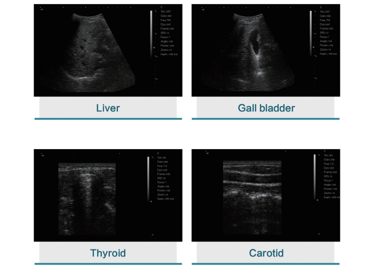 Digital Human Veterinary Portable Ultrasound Machine Ultrasound Portable Ultrasound