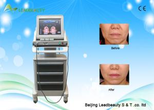 China Portable hifu machine for wrinkle removal / hifu face lift skin rejuvenation factory