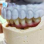 Nature Surface Universal Compatible Multiple Choices Implant operation cases for