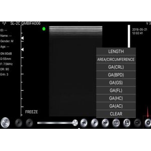 China Wireless Usb Ultrasound Scanner Linear Convex Phased 3 IN 1 factory
