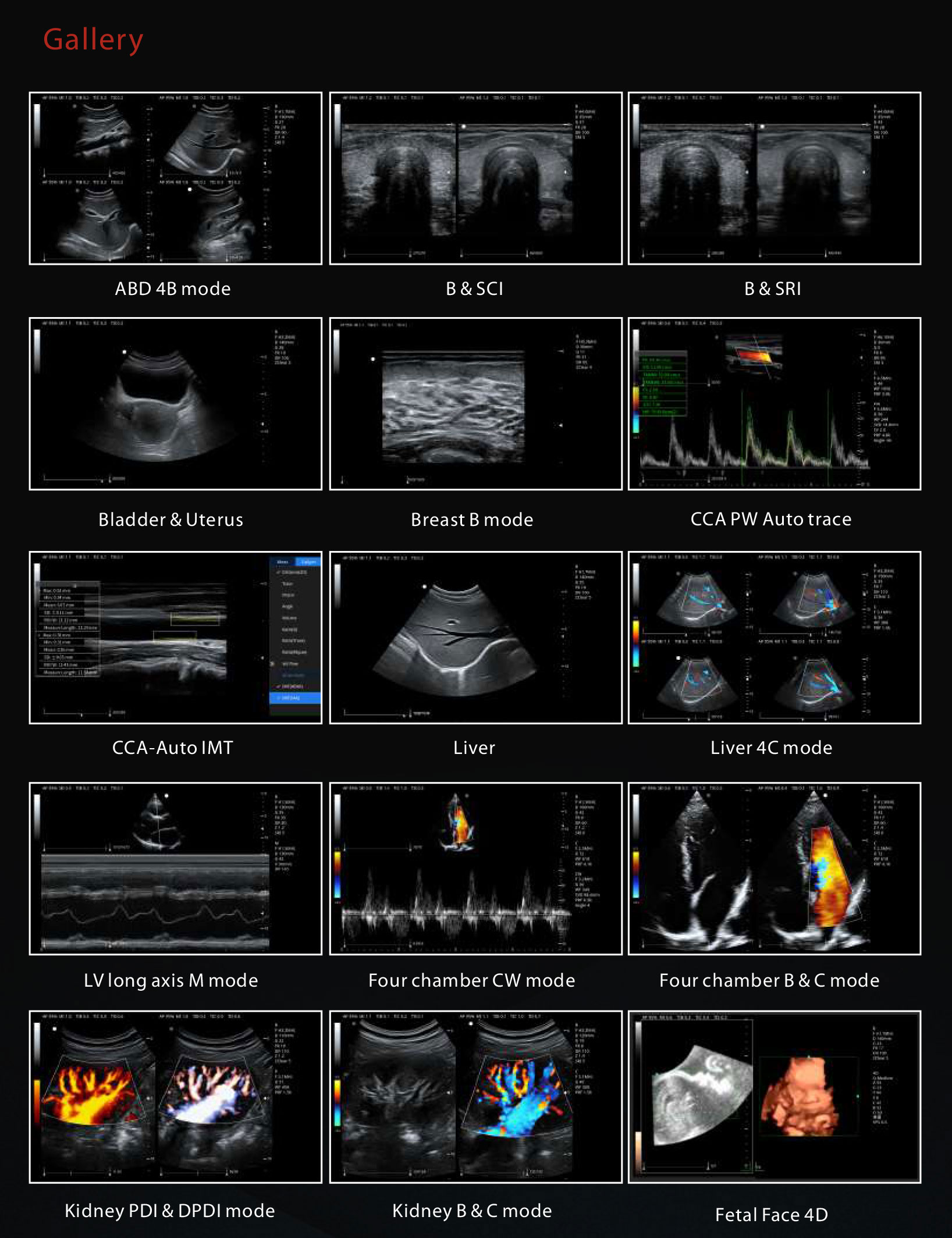 Zoncare 3D/4D Trolley Medical Digital Color Doppler Ultrasound System for Hospital