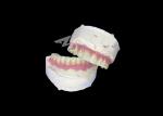 Dental All-on-6 Dental Implant Supported Dentures With Stability And Comfort