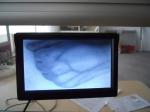 Portable Flexible Screen Venipuncture Device Infrared Vein Finder / Vein Locator