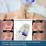 Skin Tightening RF Microneedling Machine