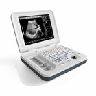 China 15 Inch LED Color Portable Ultrasound Machine with 60deg Scan Angle and 8 TGC Control factory
