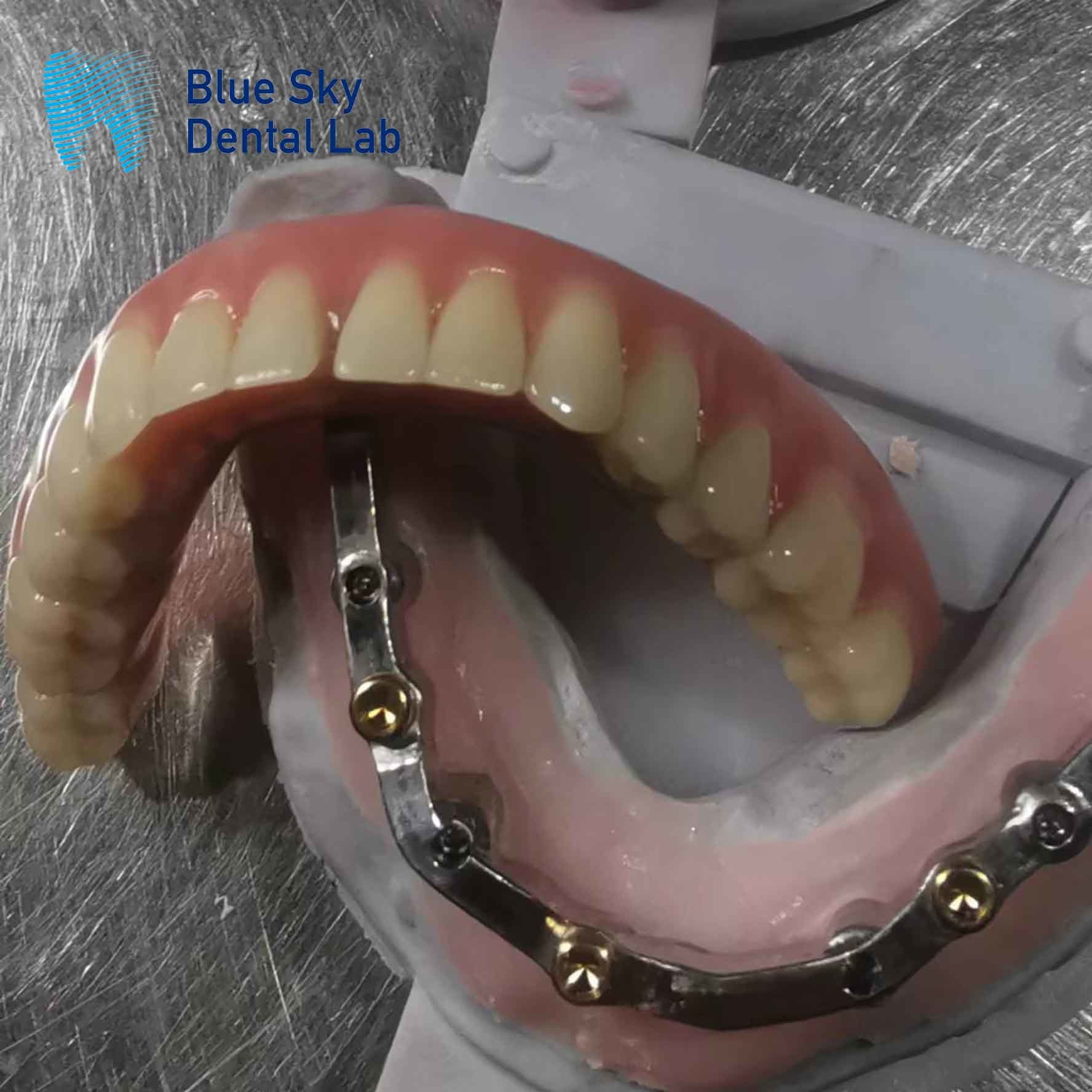 Universal Multiple Choices Implant Cases Designed For Smooth Surface And Sterile Steam Cleaning