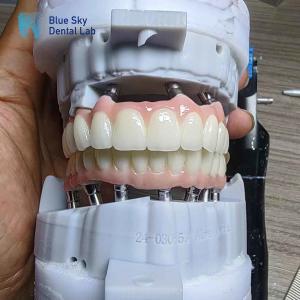 China Layered Zirconia Implant Customization Full Arch Implant Cases factory