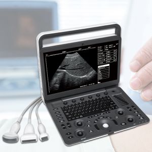 High Quality Ultrasonic SonoScape E2 with Ultrasonic Sensors