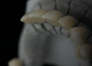 China Fit Monolithic Zirconia Tooth Crown With Translucency And Resistance factory