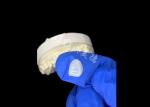 IPS e.max Veneers for incisor in shade A1 Natural Aesthetics for Flawless Smiles